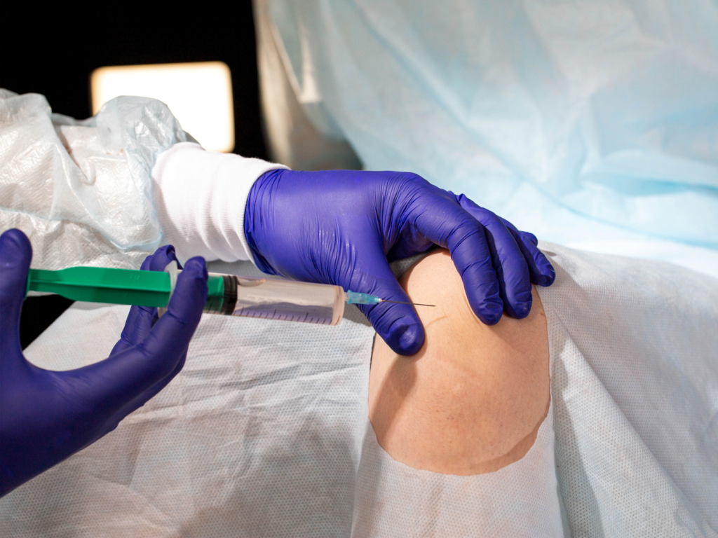 Knee Injection Procedure. Knee Injection Sites